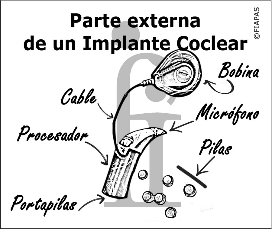 Componentes externos del implante coclear
